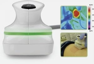 truSculpt device