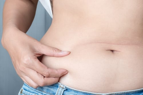 women pulls the belly skin showing fat in the abdomen and flanks-img-blog