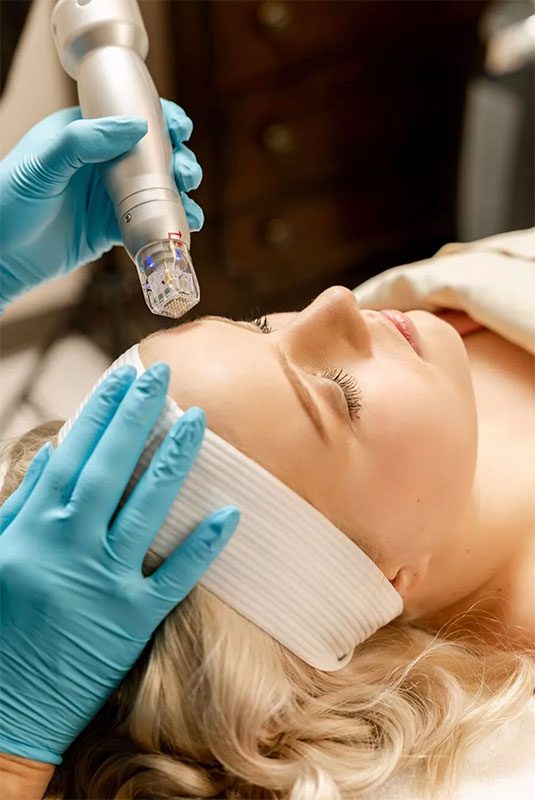 Scarlet SRF Microneedling with Radio Frequency only $550