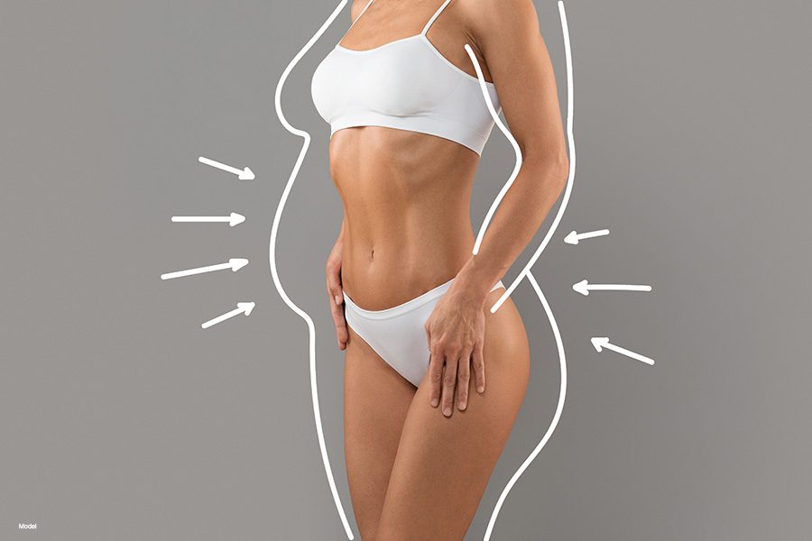 Liposuction concept image, woman's torso with dotted lines suggesting weight loss